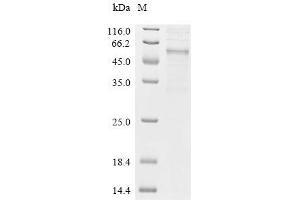 (Tris-Glycine gel) Discontinuous SDS-PAGE (reduced) with 5 % enrichment gel and 15 % separation gel.