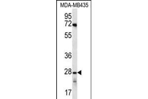 OR10AG1 Antibody (C-term) (ABIN656252 and ABIN2845567) western blot analysis in MDA-M cell line lysates (35 μg/lane).