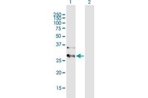 Western Blot analysis of HIBADH expression in transfected 293T cell line by HIBADH MaxPab polyclonal antibody. (HIBADH 抗体  (AA 1-336))