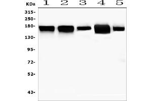Western blot analysis of MTUS1 using anti-MTUS1 antibody (ABIN6719607).