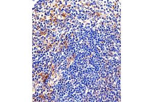 Immunohistochemical analysis of paraffin-embedded M. (LYN 抗体  (AA 229-263))