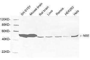 Western blot analysis of tissue and cell lysates using 1 µg/mL Rabbit Anti-NSE Polyclonal Antibody (ABIN398881) The signal was developed with IRDye TM800 Conjugated Goat Anti-Rabbit IgG. (ENO2/NSE 抗体  (C-Term))