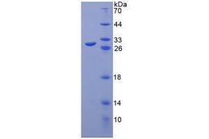 SDS-PAGE analysis of Human Toll Like Receptor 8 Protein. (TLR8 蛋白)
