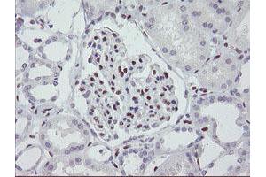 Image no. 1 for anti-Meis Homeobox 3 (MEIS3) (AA 1-261) antibody (ABIN1490670) (MEIS3 抗体  (AA 1-261))