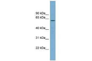 WB Suggested Anti-RIOK2 Antibody Titration: 0. (RIOK2 抗体  (Middle Region))