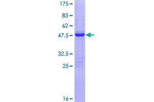 Image no. 1 for Fibroblast Growth Factor 1 (Acidic) (FGF1) (AA 1-155) protein (GST tag) (ABIN1353990)