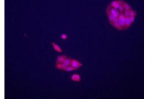 Immunofluorecence staining of anti-GPC3 Pab (cat (ABIN652202 and ABIN2840751)) on HepG2 cells. (Glypican 3 抗体  (C-Term))