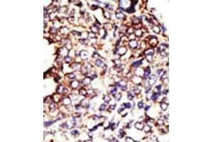Image no. 1 for anti-Glucosaminyl (N-Acetyl) Transferase 1, Core 2 (GCNT1) (Middle Region) antibody (ABIN357691)
