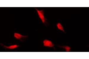 ABIN6267558 staining HeLa by IF/ICC. (HDAC4 抗体  (pSer632))