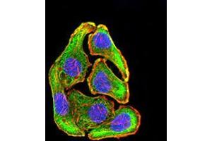 Immunocytochemistry (ICC) image for anti-Mitogen-Activated Protein Kinase Kinase 3 (MAP2K3) (AA 1-138) antibody (ABIN5903232)