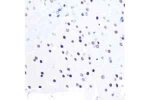 Immunohistochemistry of paraffin-embedded mouse brain using PEG3 Rabbit pAb (ABIN6128527, ABIN6145434, ABIN6145435 and ABIN6216398) at dilution of 1:100 (40x lens). (PEG3 抗体  (AA 1-300))