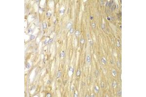 Immunohistochemistry of paraffin-embedded human esophageal using PPP2R2A antibody at dilution of 1:100 (400x lens). (PPP2R2A 抗体)