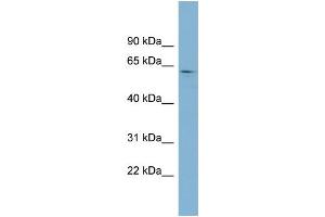 WB Suggested Anti-EPB41 Antibody Titration:  0. (EPB41 抗体  (Middle Region))