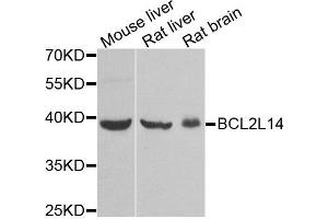 Western blot analysis of extracts of various tissues, using BCL2L14 antibody. (BCL2L14 抗体)