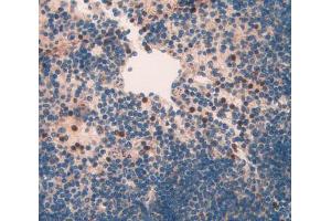 IHC-P analysis of spleen tissue, with DAB staining. (NAIP 抗体  (AA 500-759))