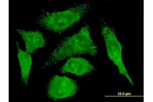 Immunofluorescence of monoclonal antibody to S100A10 on HeLa cell. (S100A10 抗体  (AA 1-97))