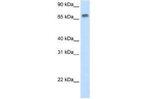 WB Suggested Anti-Mta2 Antibody Titration:  0. (MTA2 抗体  (N-Term))