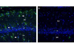 Expression of C5aR2 in rat hippocampus. (GPR77 抗体  (Extracellular))