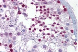 Immunohistochemistry with Testis tissue at an antibody concentration of 5µg/ml using anti-PITX3 antibody (ARP33033_P050) (PITX3 抗体  (N-Term))