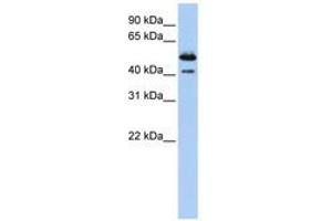 Image no. 1 for anti-Deoxyribonuclease II beta (DNASE2B) (AA 288-337) antibody (ABIN6740777) (DNASE2B 抗体  (AA 288-337))