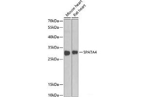 Western blot analysis of extracts of various cell lines using SPATA4 Polyclonal Antibody at dilution of 1:1000. (SPATA4 抗体)