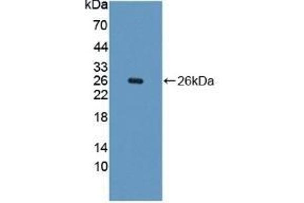 Phenylalanine Hydroxylase 抗体  (AA 228-452)