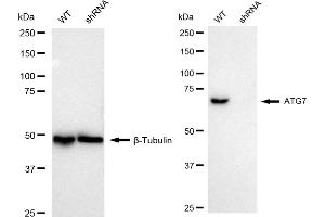 Western blotting analysis using ATG7 antibody (ABIN7797676). (Recombinant ATG7 抗体)