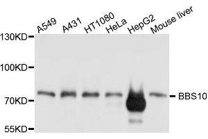 Western blot analysis of extract of various cells, using BBS10 antibody. (BBS10 抗体)