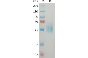 Human ST2 Protein, His Tag on SDS-PAGE under reducing condition.
