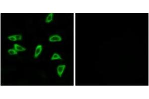 Immunofluorescence analysis of LOVO cells, using PTGER3 Antibody. (PTGER3 抗体  (AA 16-65))