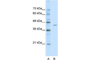 WB Suggested Anti-ZBTB26 Antibody Titration:  0. (ZBTB26 抗体  (Middle Region))