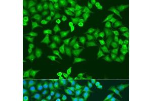 Immunofluorescence analysis of U2OS cells using RRM1 Polyclonal Antibody at dilution of 1:100. (RRM1 抗体)