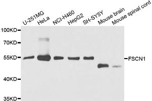Western blot analysis of extracts of various cell lines, using FSCN1 antibody (ABIN5975344) at 1/1000 dilution. (Fascin 抗体)