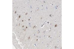 Immunohistochemical staining of human hippocampus with LRCH1 polyclonal antibody  shows distinct nuclear positivity in neuronal cells at 1:200-1:500 dilution. (LRCH1 抗体)