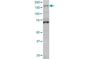 LMTK3 monoclonal antibody (M02A), clone 2H6 Western Blot analysis of LMTK3 expression in Hela S3 NE . (LMTK3 抗体  (AA 1151-1250))
