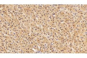 Detection of S100A6 in Porcine Liver Tissue using Polyclonal Antibody to S100 Calcium Binding Protein A6 (S100A6)