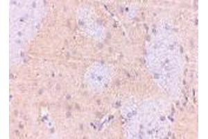 Immunohistochemistry of GPAT1 in rat brain with GPAT1 antibody at 2. (GPAM 抗体  (C-Term))