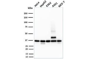 Western Blot Analysis of HeLa, HepG2, K562, A431 and MCF-7 cell lysate using RAD51 Mouse Monoclonal Antibody (RAD51/2701). (RAD51 抗体  (AA 1-134))