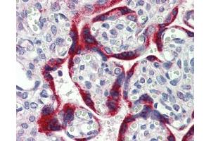 MKNK2 antibody was used for immunohistochemistry at a concentration of 4-8 ug/ml. (MKNK2 抗体  (N-Term))