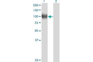 Western Blotting (WB) image for anti-Nuclear Receptor Subfamily 3, Group C, Member 1 (Glucocorticoid Receptor) (NR3C1) (AA 51-140) antibody (ABIN561138)