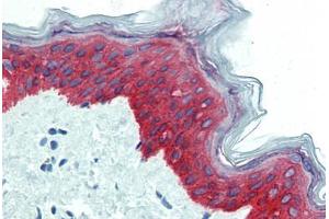Skin, Human: Formalin-Fixed, Paraffin-Embedded (FFPE) (KRT14 抗体  (C-Term))