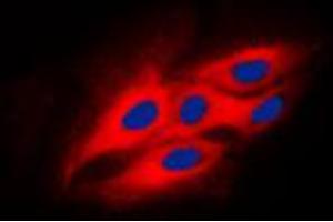Immunofluorescent analysis of Beta-glucosidase 2 staining in HeLa cells. (GBA2 抗体  (Center))