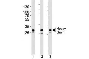 Western blot analysis of lysate from (1) A431, (2) MCF-7, (3) SK-BR-3 cell line using Cathepsin D antibody at 1:1000. (Cathepsin D 抗体  (Heavy Chain))