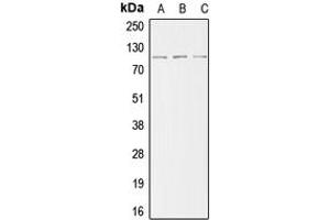 Western blot analysis of ACTN2 expression in HeLa (A), mouse kidney (B), H9C2 (C) whole cell lysates. (ACTN2 抗体  (N-Term))