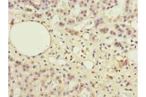 Immunohistochemistry of paraffin-embedded human adrenal gland tissue using ABIN7169283 at dilution of 1:100 (PPP2R3B 抗体  (Regulatory Subunit B))