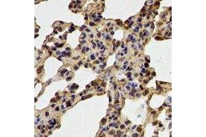 Immunohistochemical analysis of Glutathione Synthetase staining in mouse lung formalin fixed paraffin embedded tissue section. (Glutathione Synthetase 抗体)