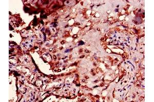 Immunohistochemistry of paraffin-embedded human placenta tissue using ABIN7166476 at dilution of 1:100 (PTMA 抗体  (AA 5-110))