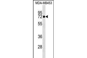 ZNF57 Antibody (N-term) (ABIN1539583 and ABIN2849296) western blot analysis in MDA-M cell line lysates (35 μg/lane). (ZFP57 抗体  (N-Term))