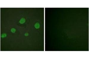 Immunofluorescence analysis of HuvEc cells, using GATA3 (Phospho-Ser308) Antibody. (GATA3 抗体  (pSer308))