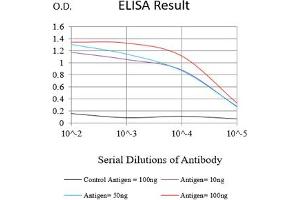Black line: Control Antigen (100 ng),Purple line: Antigen (10 ng), Blue line: Antigen (50 ng), Red line:Antigen (100 ng) (PAX8 抗体  (AA 300-450))
